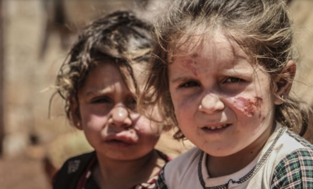 Alarming Surge: South Waziristan Reports 255 Leishmaniasis Cases in 2026